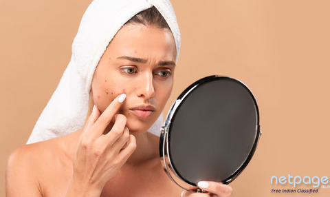 Acne Treatment in Ludhiana