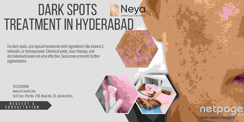 Dark Spots Treatment in Hyderabad