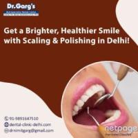 Get a Brighter, Healthier Smile with Scaling & Polishing in Delhi! 